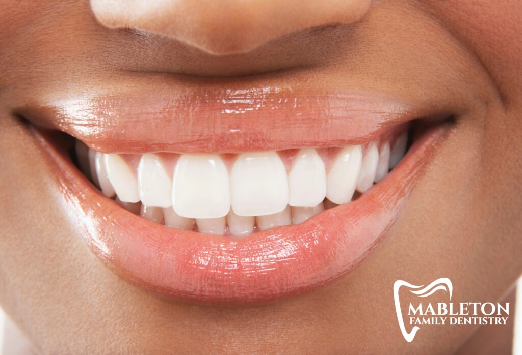 The Benefits of Teeth Whitening for Your Oral Health