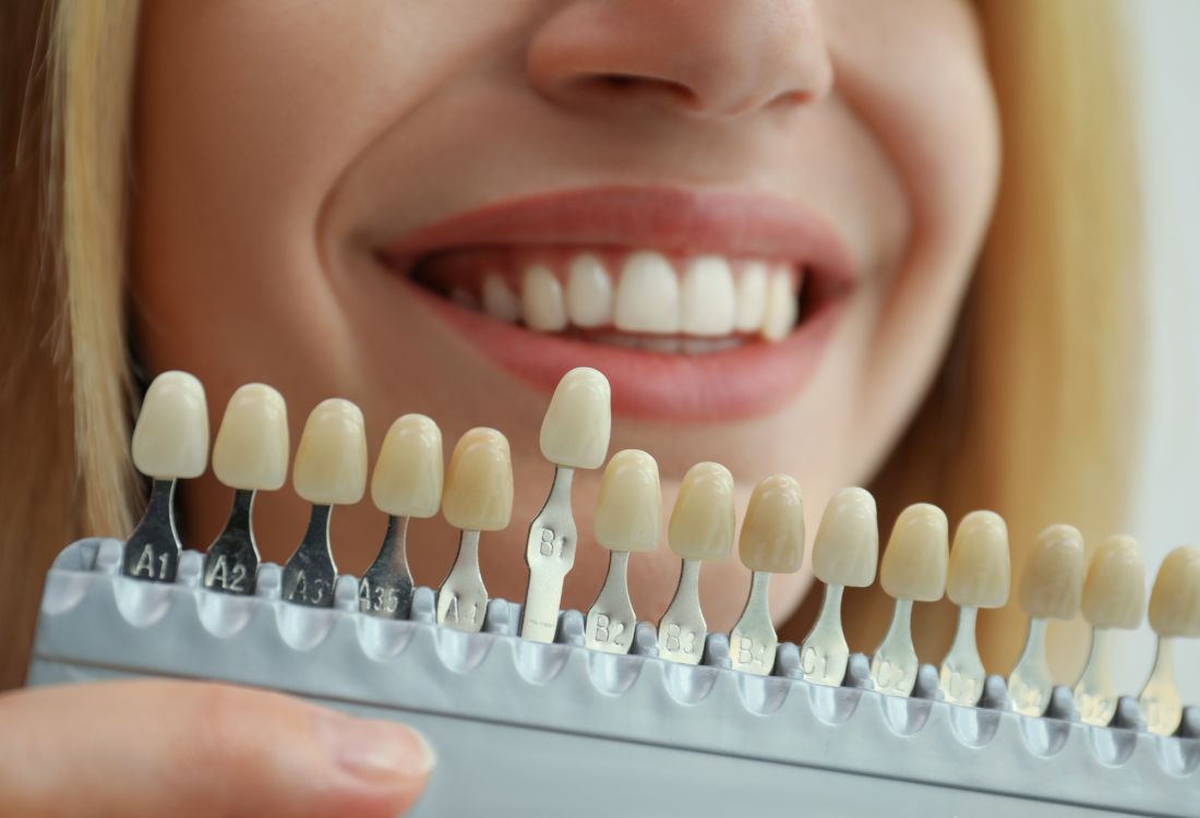 The Advantages of Cosmetic Dentistry