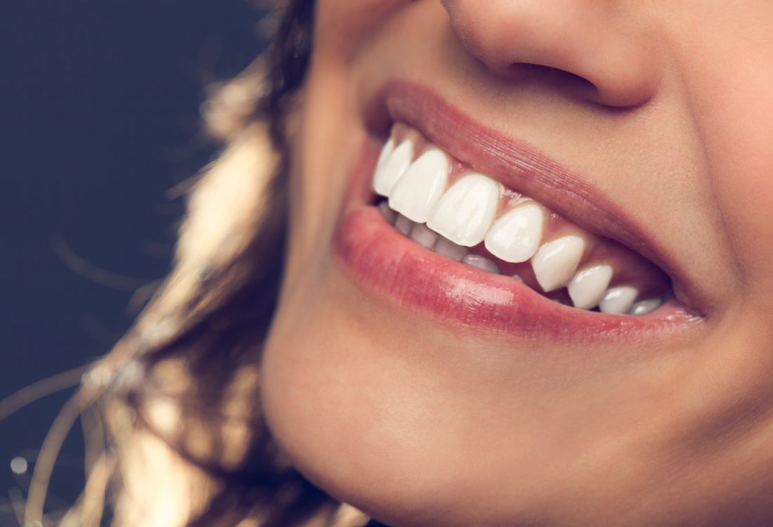 Transform Your Smile with Veneers