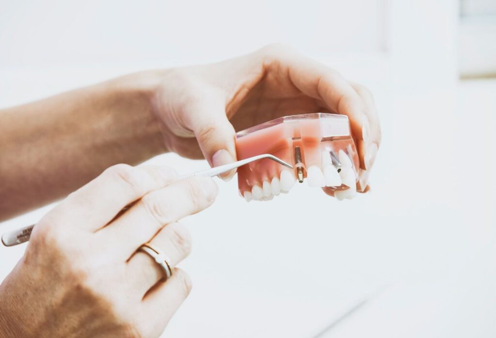dental implants Mableton